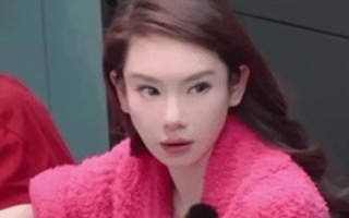 戚薇大方承认过度医美 称打肉毒打僵眉毛