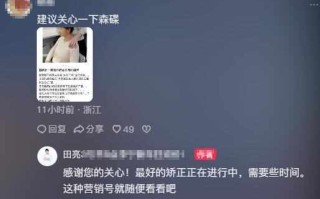 16岁森碟下巴后缩 医生称或影响口腔功能