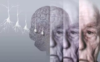 我们不知道答案的125个科学问题(91)阿尔兹海默症 精选
